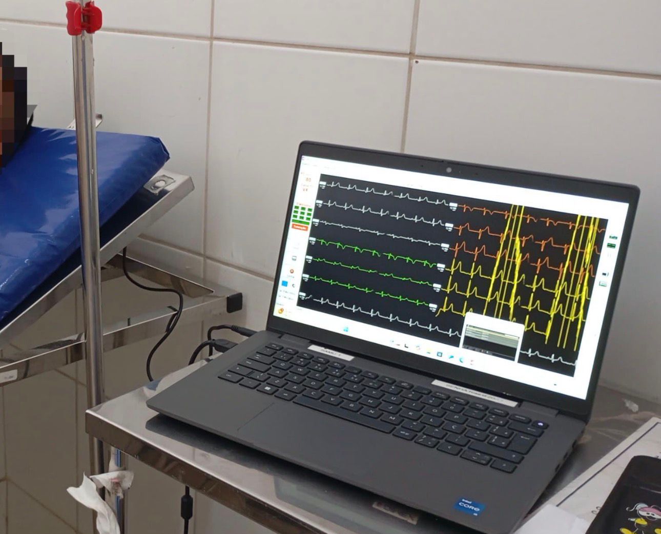 GCM localiza e prende suspeito por furto de notebook em UPA de Aparecida